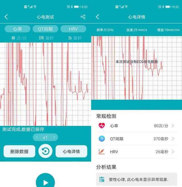 半导体|深度健康运动随身管理,didoG28S年轻人的第一支健康智能手表