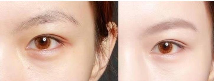 减肥误区 有哪些好用的抗老眼霜？这4款A醇眼霜兼顾效果与温和度，值得推荐