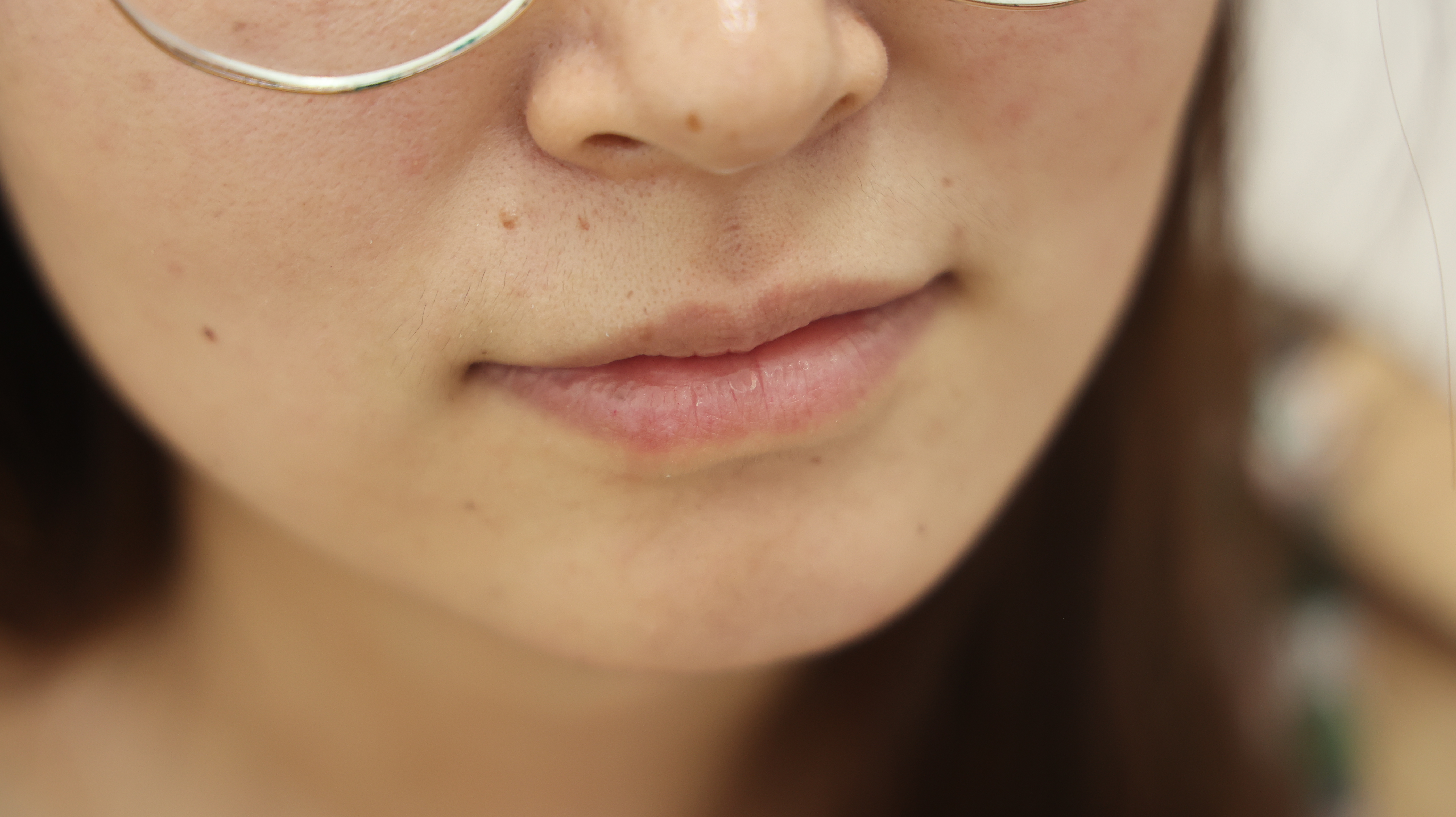 牙齿|血管堵塞脸先知！当脸部出现这3个表现时，或是血管堵塞的征兆