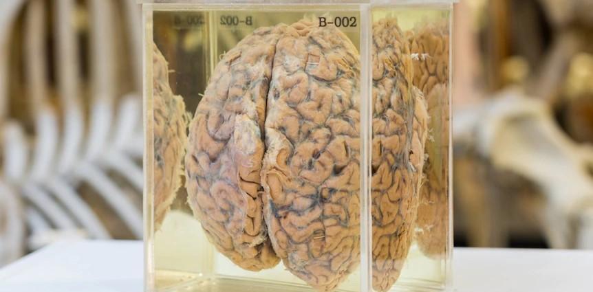 哲学家死后遗嘱:把自己的大脑捐给哲学,而不是科学,也不是医学