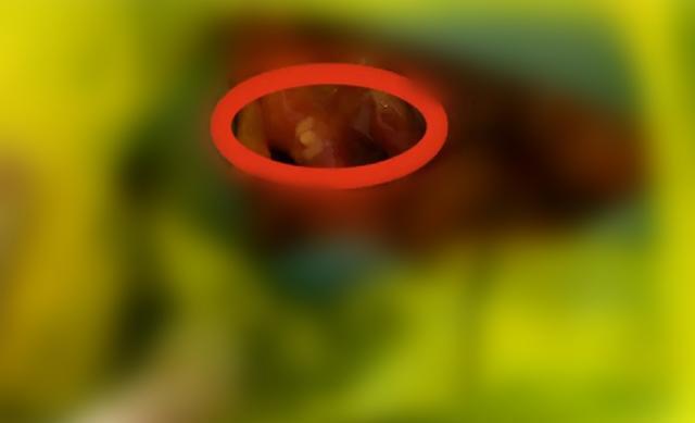 因性别鉴定为女选择引产,结果是男孩,宝爸要讨公道遭全网嘲