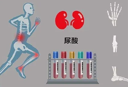 肾病|高尿酸的“催化剂”,提醒:4种“汤汤水水”少碰,或能稳定尿酸