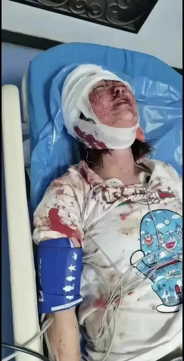 唐山事件后续!女孩验伤为轻伤,施暴者为中级伤,嘎子哥欲去探望