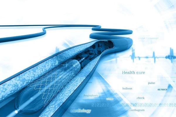 心脏|植入心脏支架后，患者能活多久？医生：需根据这些情况而定！