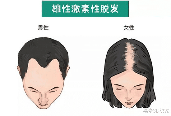 肾病|够科普，脱发知识全知道