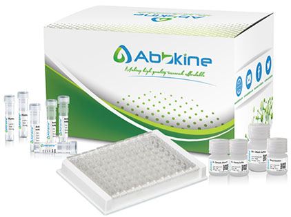 Abbkine EliKine人甲胎蛋白(AFP)ELISA定量试剂盒操作方法