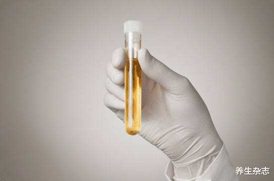 肝硬化|肝硬化有“萌芽”时,身体隐约有2个异常,想预防肝硬化,或要注意2点