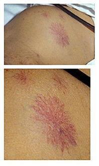 肝脏|肝脏病变时,身体可能“2处变黄,2处长痣”,占一个,最好检查下