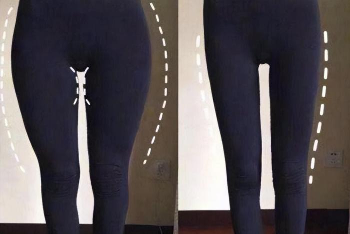 戚薇|“少女胯”与“妇女胯”有啥分别？看当红女明星的站姿，一看便知