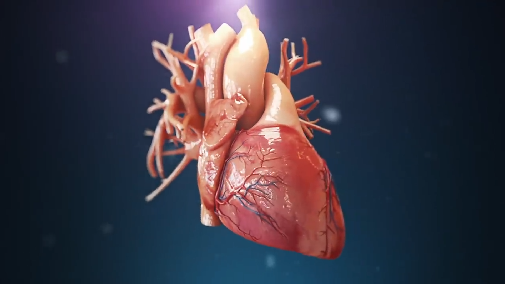 猪心脏移植患者去世，现在3D技术发达，为什么不选择3D心脏？