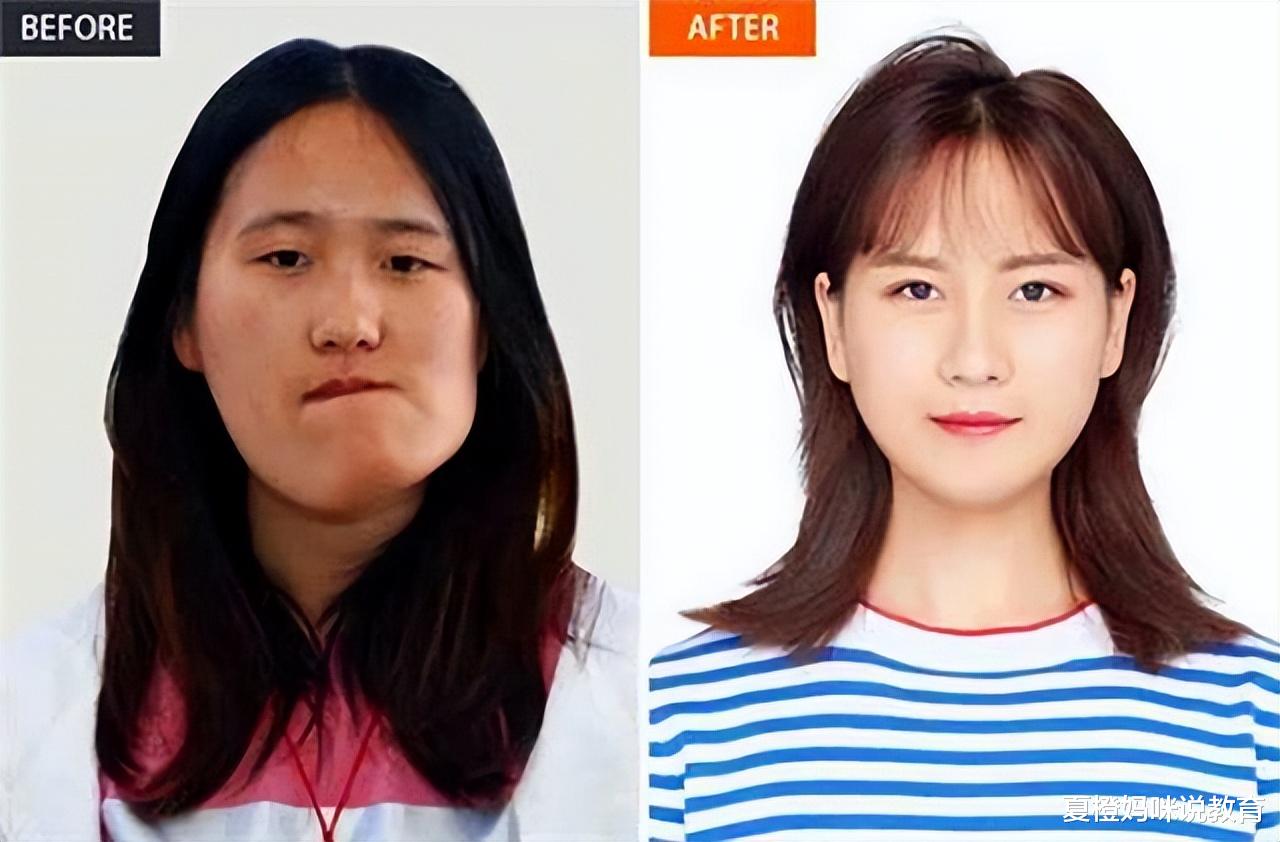 整容|女孩因长相太丑而无法当老师，整容变成美女后，她的做法让人意外