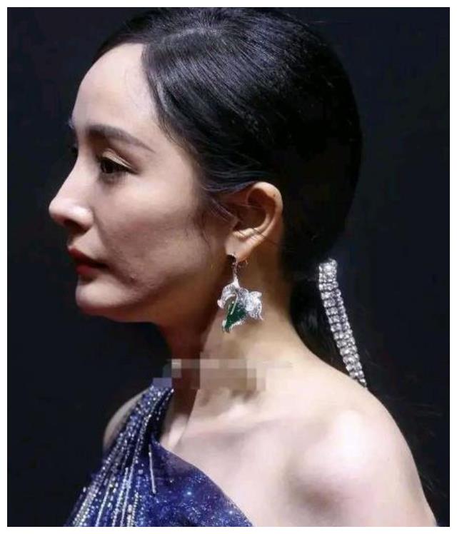 杨幂|36岁杨幂生图曝光！较2年前老了10岁，痘痘瑕疵尽显不见少女感