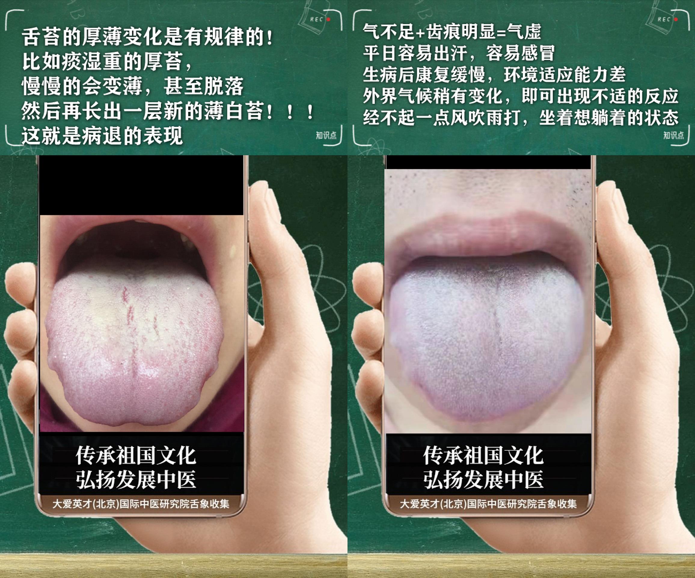 水果|中医解析:容易出汗,食欲不振,手脚无力,阴阳两虚