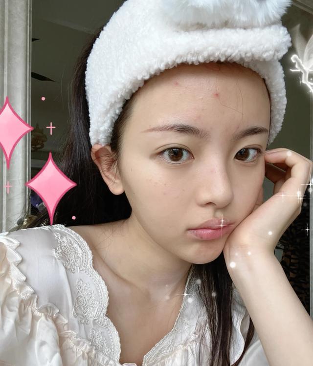 明星素颜|杨超越晒素颜照,戴美瞳脸上起痘痘,底下评论吵翻天