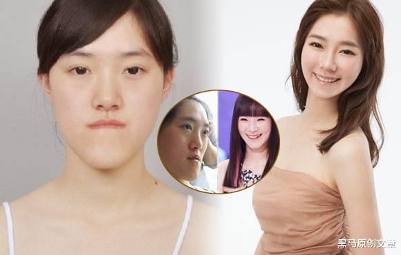 衰老|人到中年,突然想整容了……