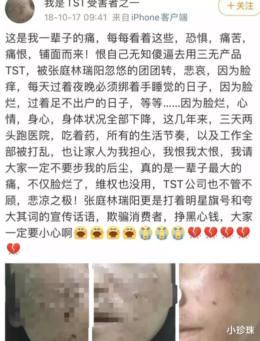 张庭|横着走的张庭夫妇夫妇是被谁扳倒的？