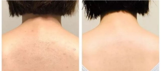 护肤 李小冉“护肤秘诀”火了，轻松养成光滑婴儿肌，金晨：我都用2年了