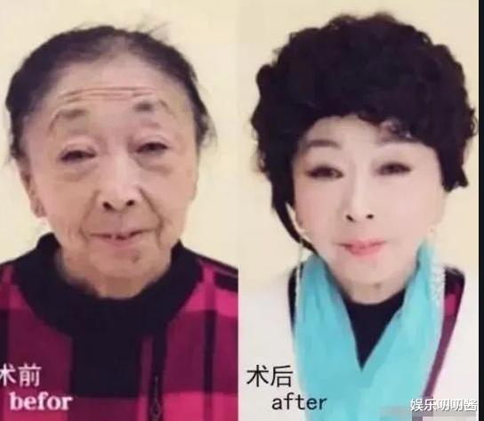 李玉成|85岁马玉琴晚年生活凄惨，感冒被按着头洗脸，网友：李玉成不装了