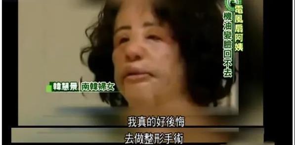 王一博|女星韩慧景:为了更漂亮,给脸注射食用油,把脸整成“猪头”