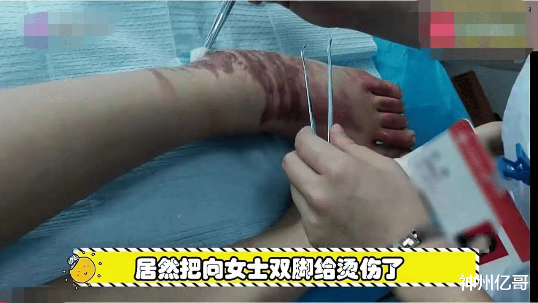 湖南长沙,女子点红糖水被烫伤索要赔偿,店家称糖水送出与我无关