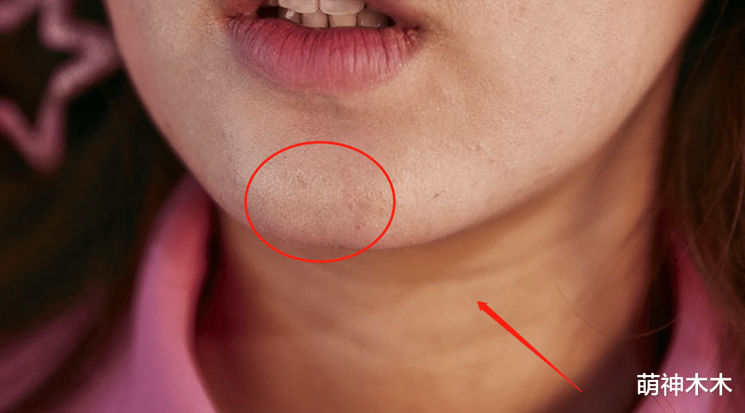 赵露思|尴尬！赵露思杂志未修图流出，五官扁平痘痘多，少女感全靠后期修