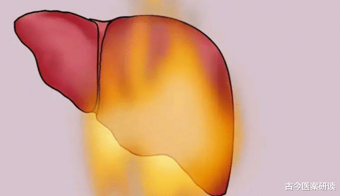 肝脏|肝火旺盛的人,通常有这“4个表现”,提示:学会一招灭肝火、气色佳