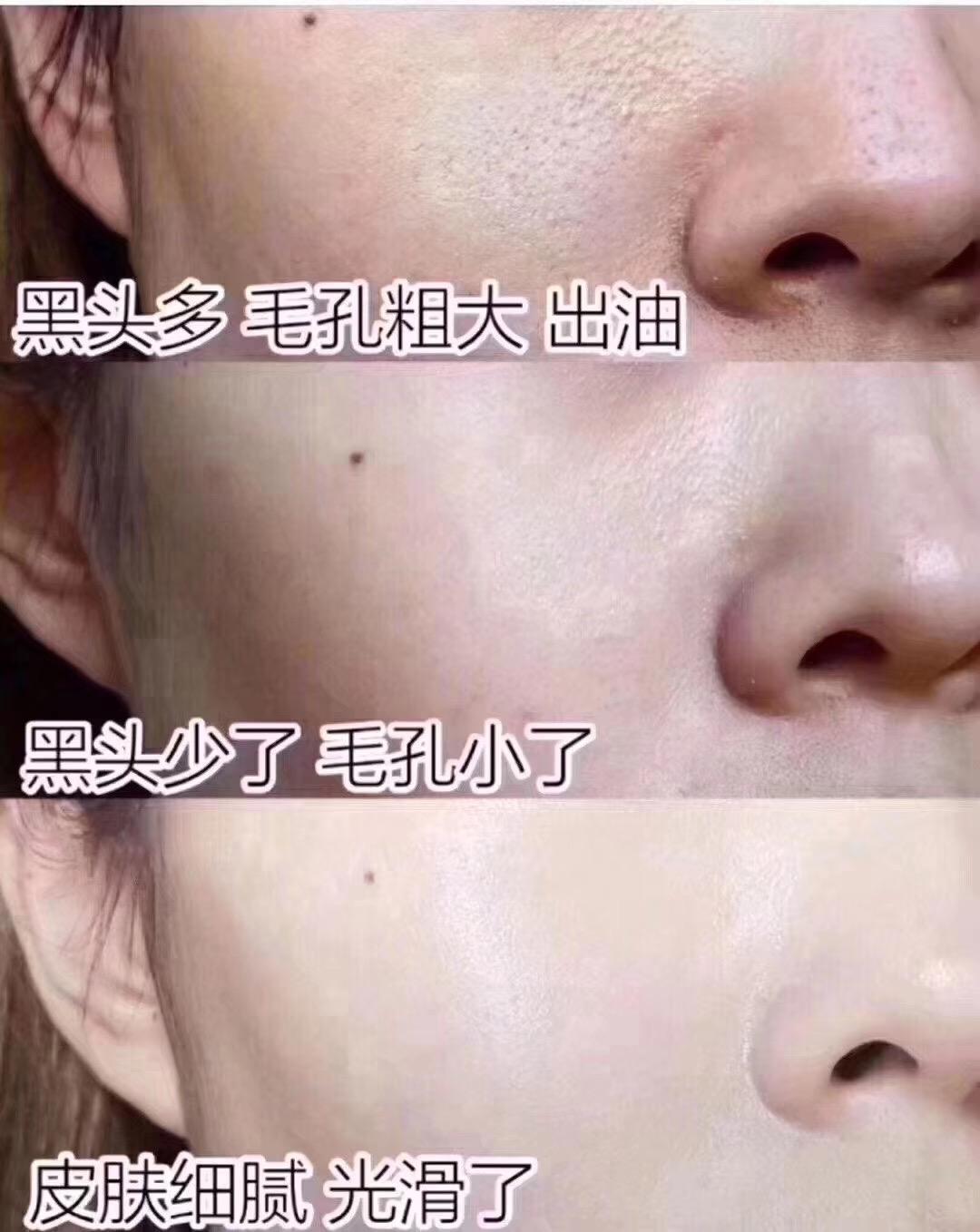 宝洁 改善毛孔粗大的几个诀窍，让你素颜也自信