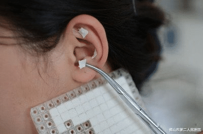 医生|心情抑郁,易怒易哭,你是不是也“郁证”频发?