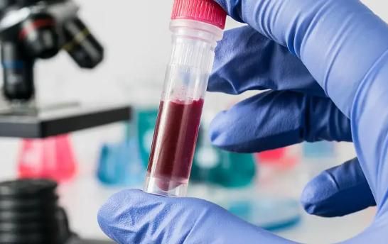 癌细胞|医生提醒:60岁以后做体检,没必要每项都做,做好5个检查即可