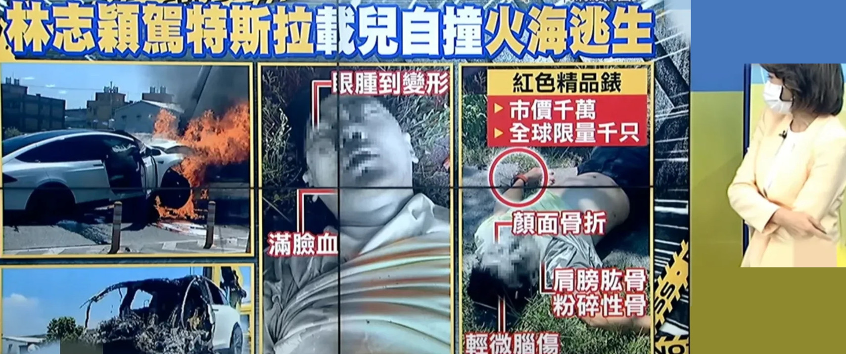 林志颖|祸不单行！林志颖脸骨重建至少1年，人还在ICU，就被当地机构索赔