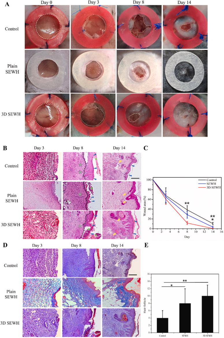 3D打印|南方医科大学最新科研进展:3D打印直写蛋清水凝胶,促进糖尿病慢性伤口愈合!