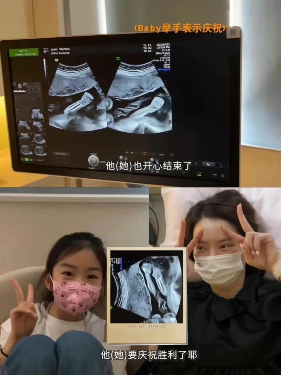 戚薇|戚薇二胎产后露面，因崴脚导致月子全程坐轮椅，努力减肥月瘦15斤