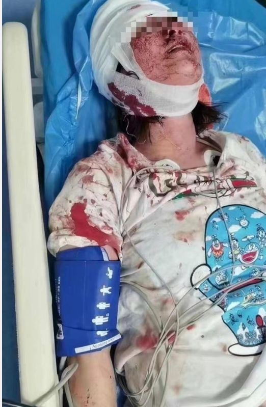 杨幂|唐山事件打人男子近照曝光，长相富态生活奢靡，网传已花60万私了