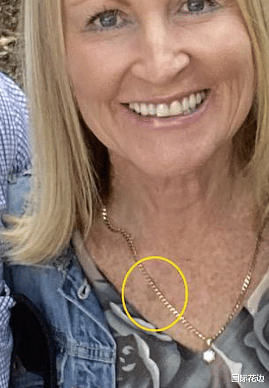 明星素颜|澳洲女子身上长斑没在意，美容师让她赶紧去看，一查是癌症