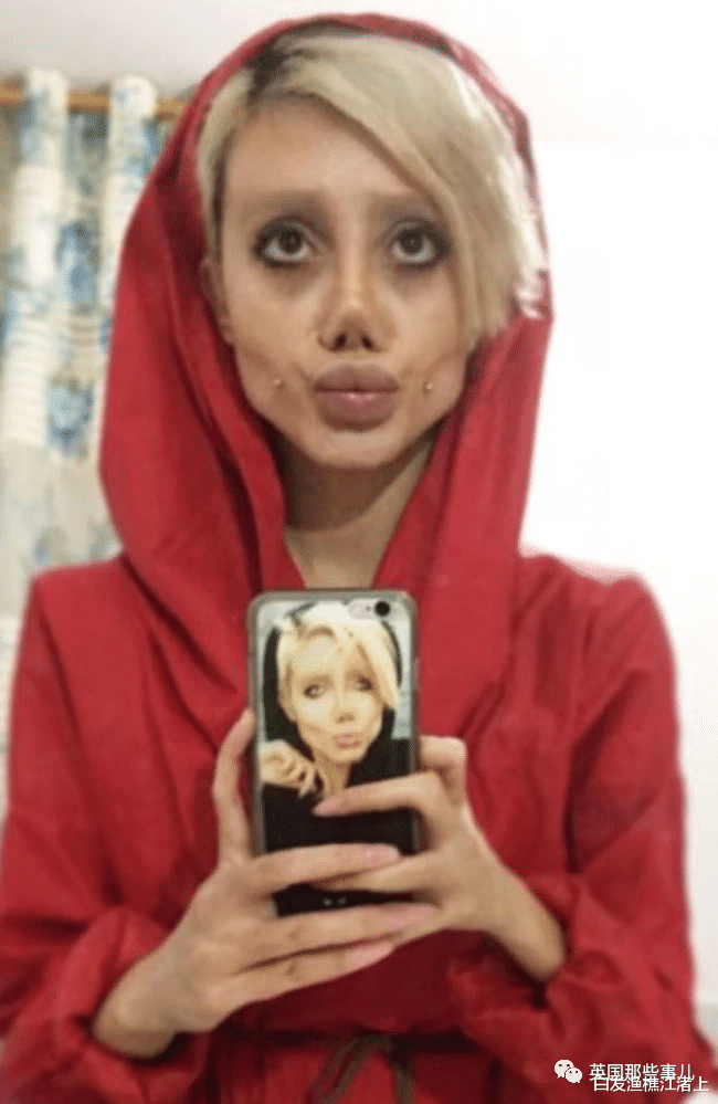 安吉丽娜·朱莉|伊朗女孩整容成“僵尸朱莉”被判刑后,终于露出真面貌!