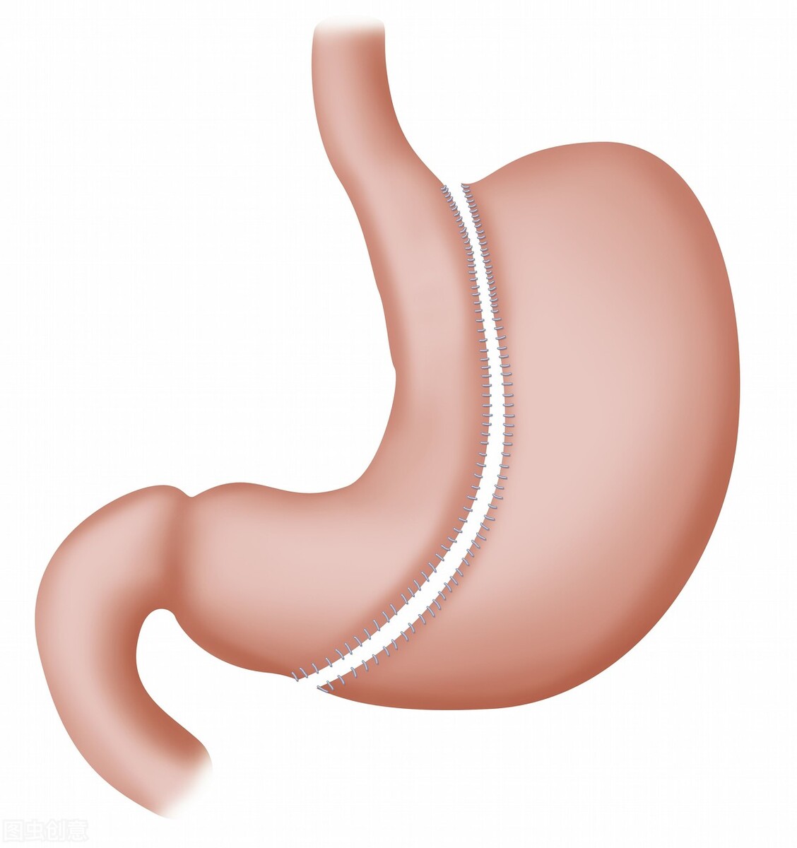 不吃晚饭可以养生或者减肥吗？长期下去，可能要承受这几个后果