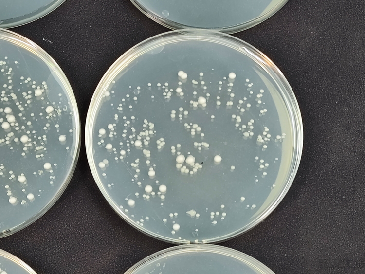 机器学习|真的能解决问题！石头A10 Plus抑菌设计实测