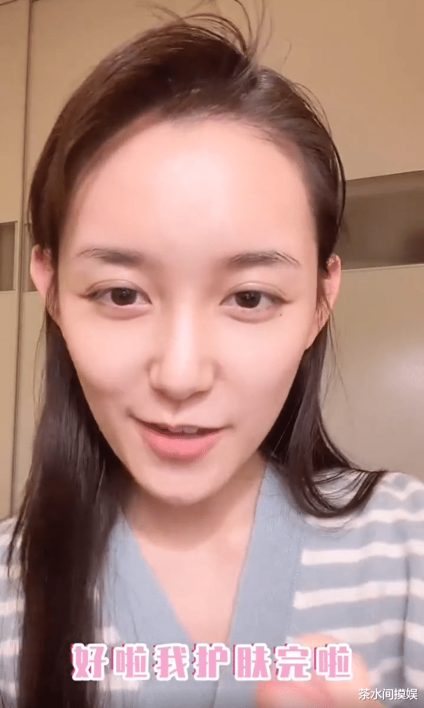 辣妹|女明星也有秃头危机？有人发际线堪比清朝阿哥，有人走路掉假发片