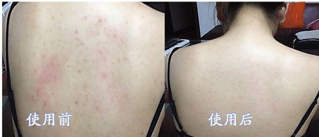 红薯 最近金晨随手晒的一款平价洁面皂,李佳琦也多次力荐,痘痘黑头全没了!
