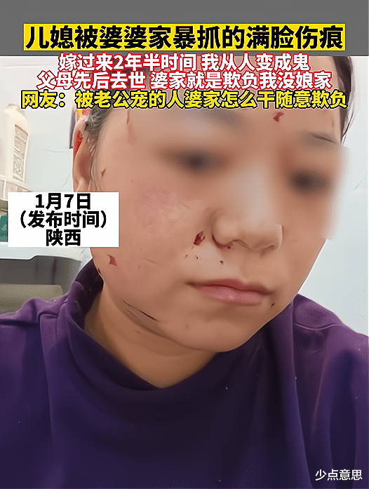 陕西:女子父母去世后,被家暴到满脸伤痕,2年半时间从人变成鬼