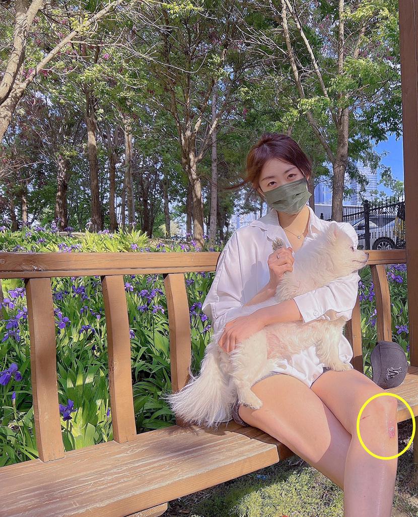 陈虹伊|五一劳动节,陈虹伊穿超短裤晒自拍!大长腿很显眼,膝盖受伤很重