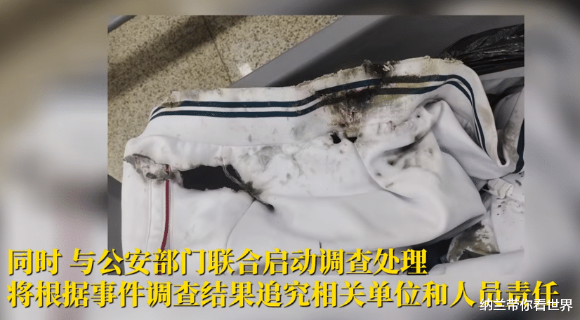 男孩地铁踩到硫酸滑倒被灼伤 警方:系刑事案件,人已抓获
