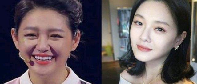 戚薇|戚薇宣布暂退娱乐圈,体重飙升快到预产期,等瘦到90斤再复出