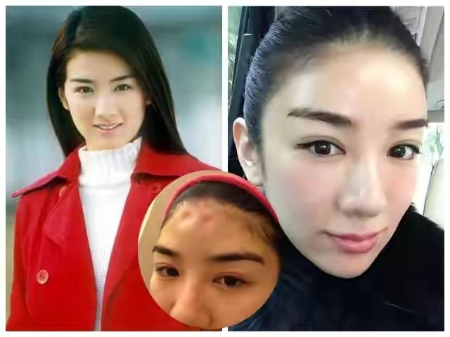 整容|好好一张美人脸,为何非要去动脸,这几位女星的脸“逆天”了!