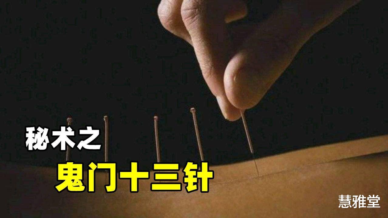 针灸|中医针灸奇术“鬼门十三针”是迷信吗？感兴趣的朋友，不妨多了解