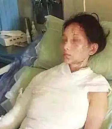 冲动是魔鬼:女顾客的一句话,惹恼17岁服务员,惨遭开水浇头