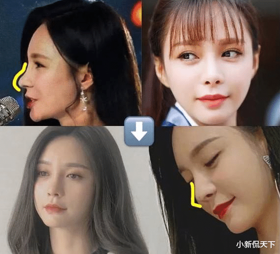 整容|整前似大妈、整完变少女？这些“回炉重造”的女明星，太成功了