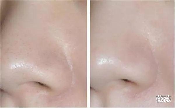 护肤品 因包装丑被“打入冷宫”的护肤品,在日本卖出“天价”,资生堂地位不保