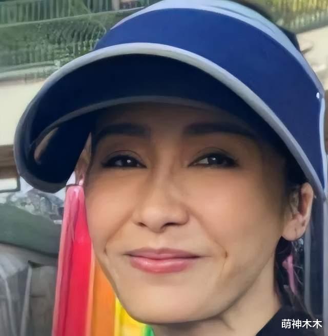 张雨绮 面部凹陷、变橡胶脸、鼻孔不对称，女明星也会无效美容