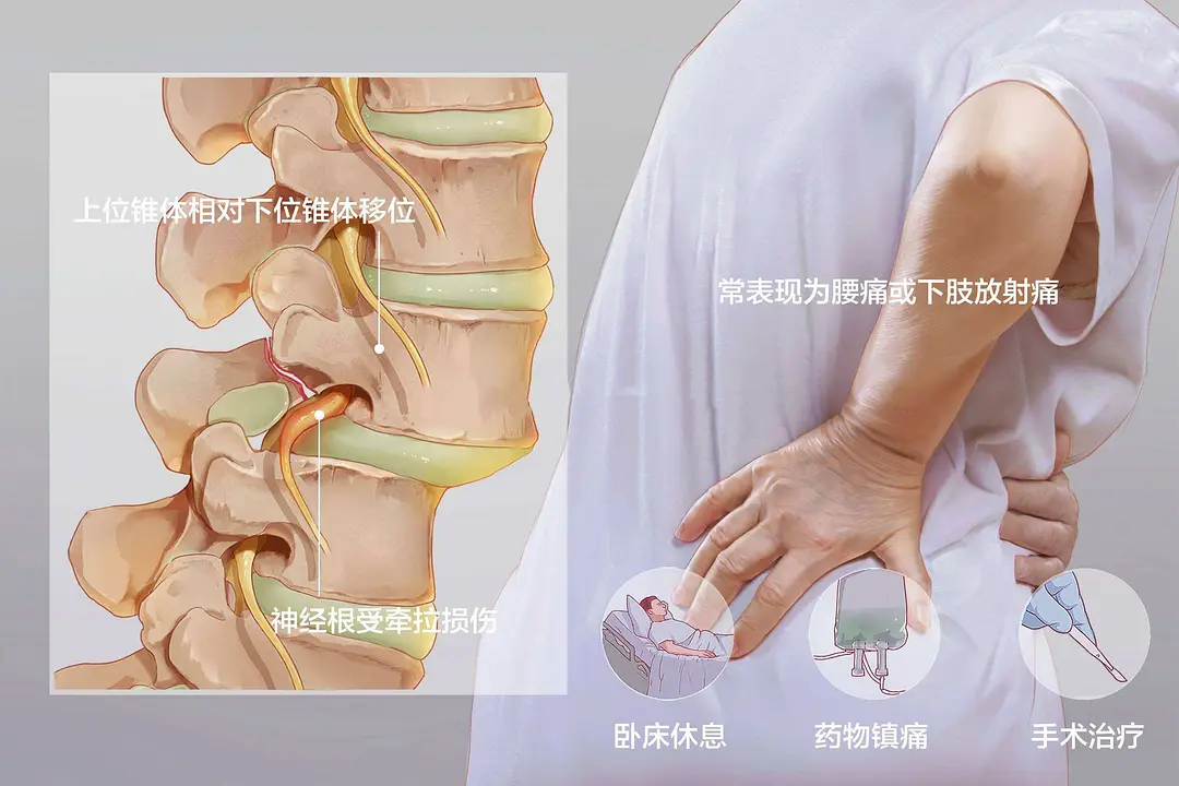 护肤品 如何判断自己得了马尾综合征?